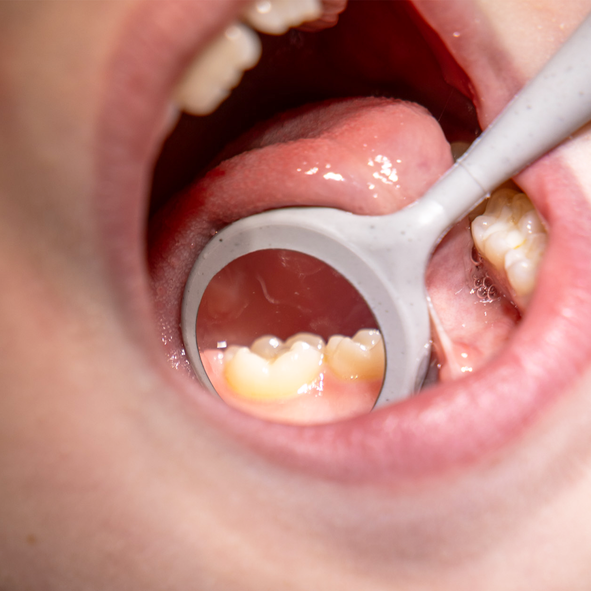 #4 Crystal HD® Double-Sided Soft Grip - 12 Count Pack