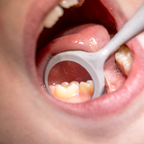 #4 Crystal HD® Double-Sided Soft Grip - 12 Count Pack